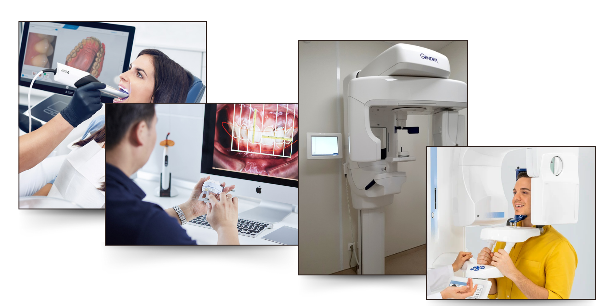 3D-Intro-Oral-Scanner