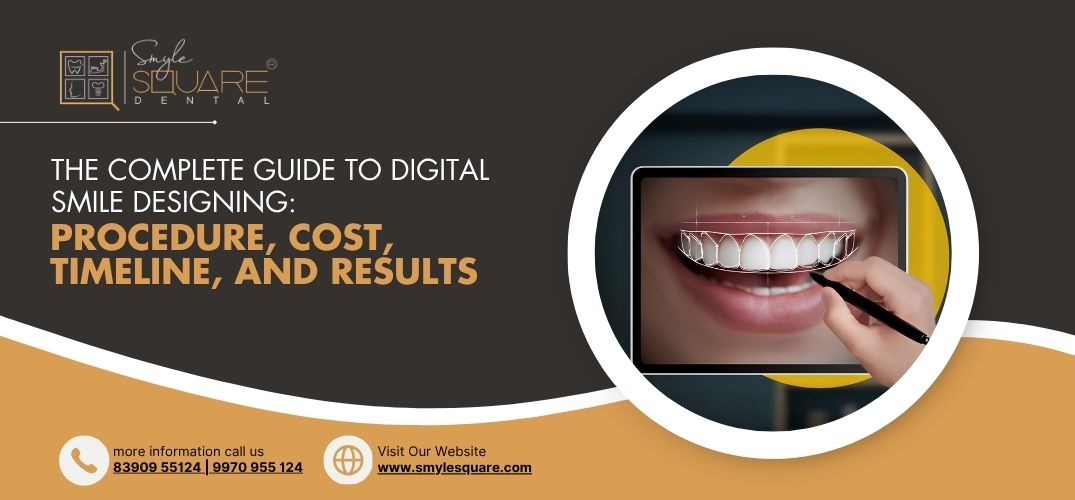 The Complete Guide to Digital Smile Designing: Procedure, Cost, Timeline, and Results